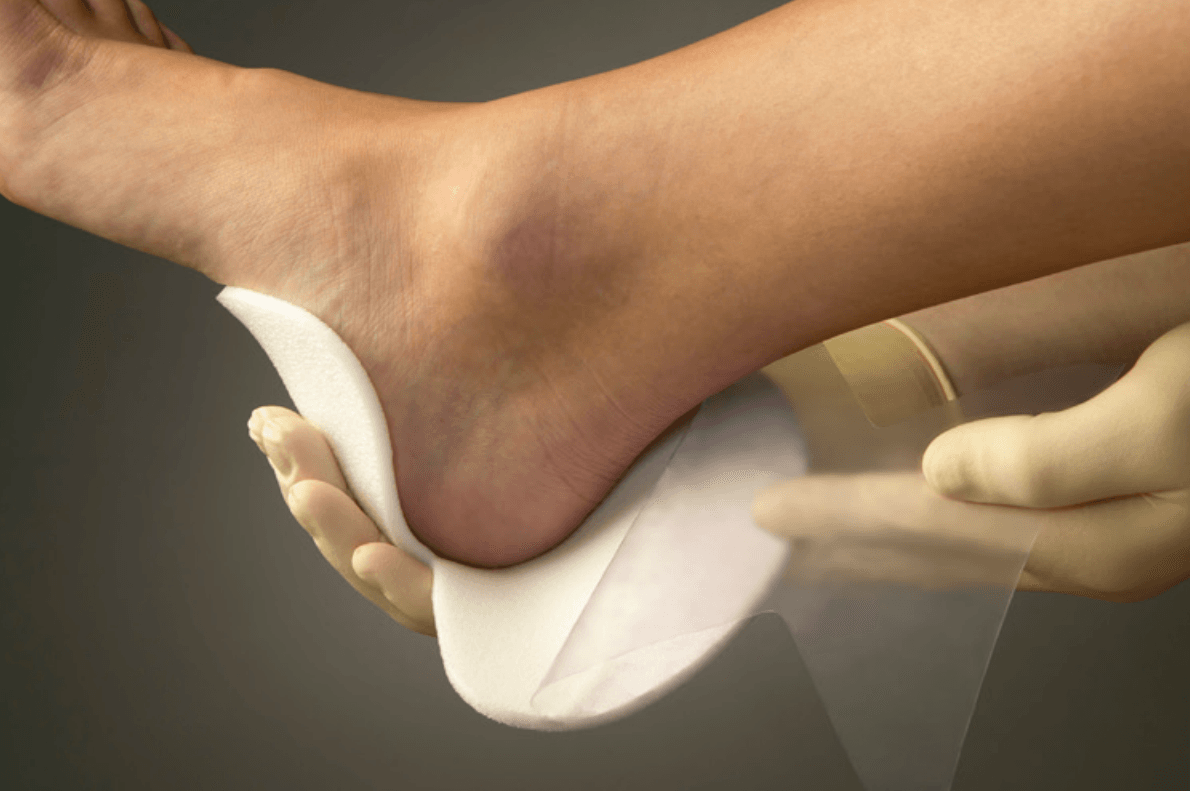 Mepilex Heel and Transfer