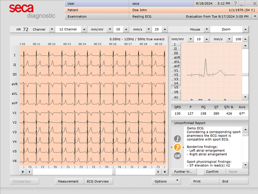 seca Sport ECG Software Licence for CT331