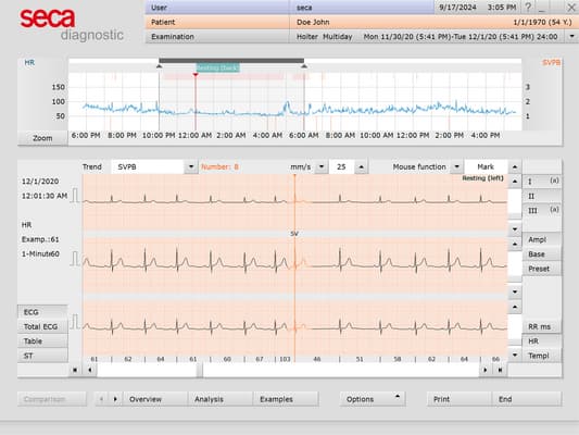 seca Holter Analysis Software | Licence | For seca guard