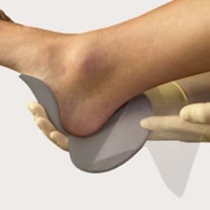 Mepilex Heel Ag Antimicrobial Foam Dressing