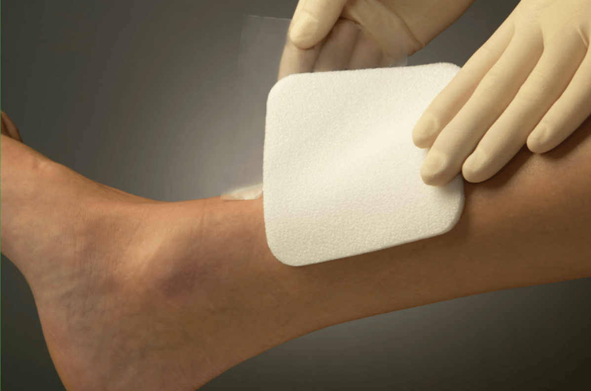 Mepilex Foam Dressing