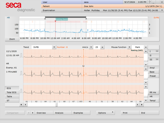 seca Holter Analysis Software | Licence | For seca guard