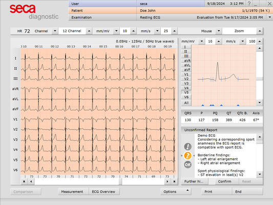seca Sport ECG Software | Licence | For CT331