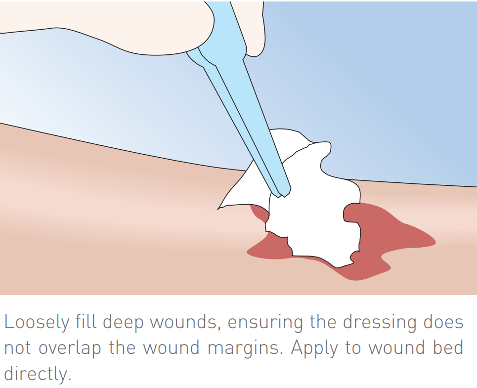 Melgisorb Ag Antimicrobial Alginate Dressing