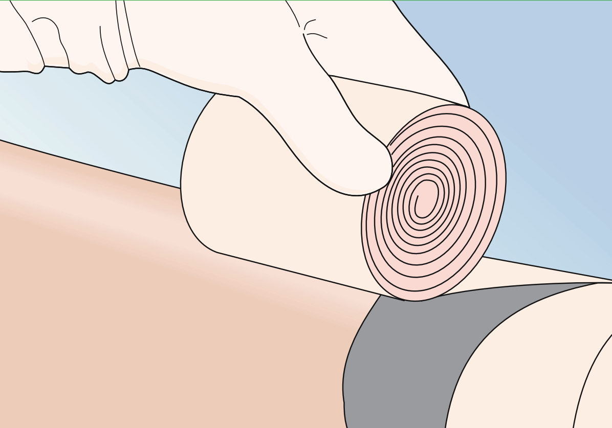 Mepilex Ag Antimicrobial Foam Dressing