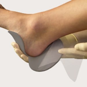 Mepilex Heel Ag Antimicrobial Foam Dressing