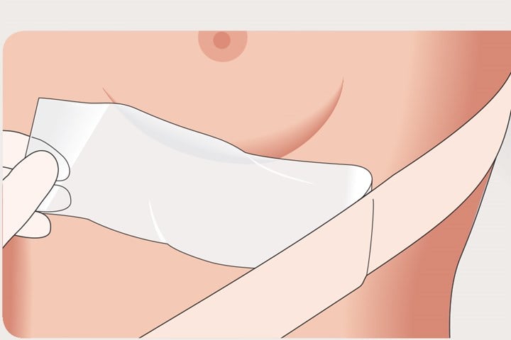 Mepiform Scar Treatment Dressing