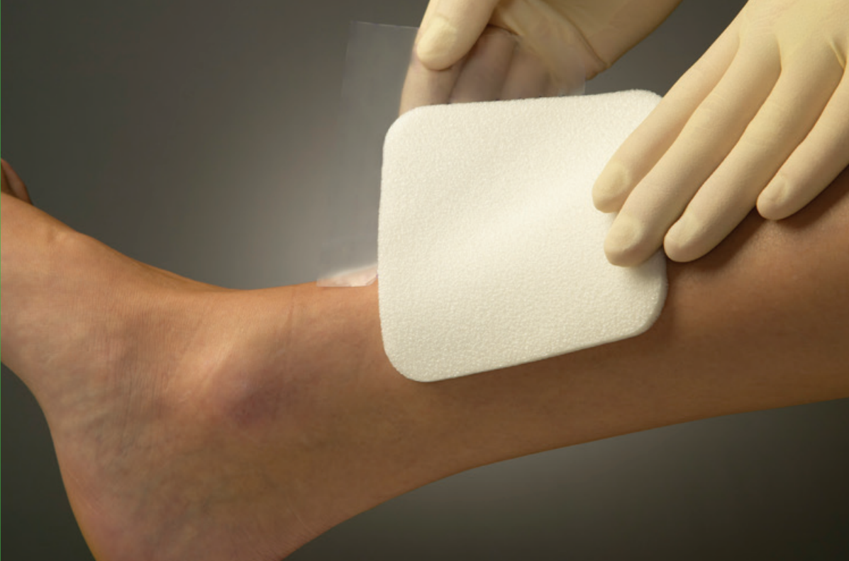 Mepilex Foam Dressing