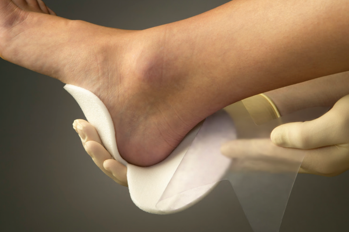 Mepilex Heel and Transfer