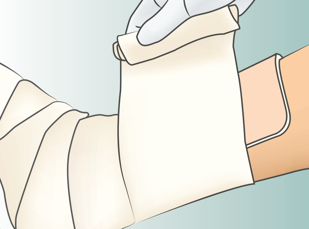 Lyofoam Max Foam Dressing