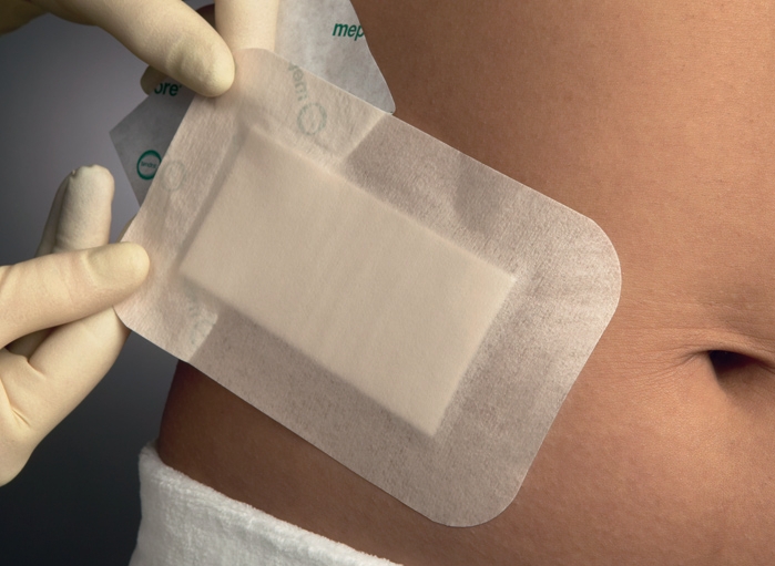 Mepore Ultra Composite Dressing