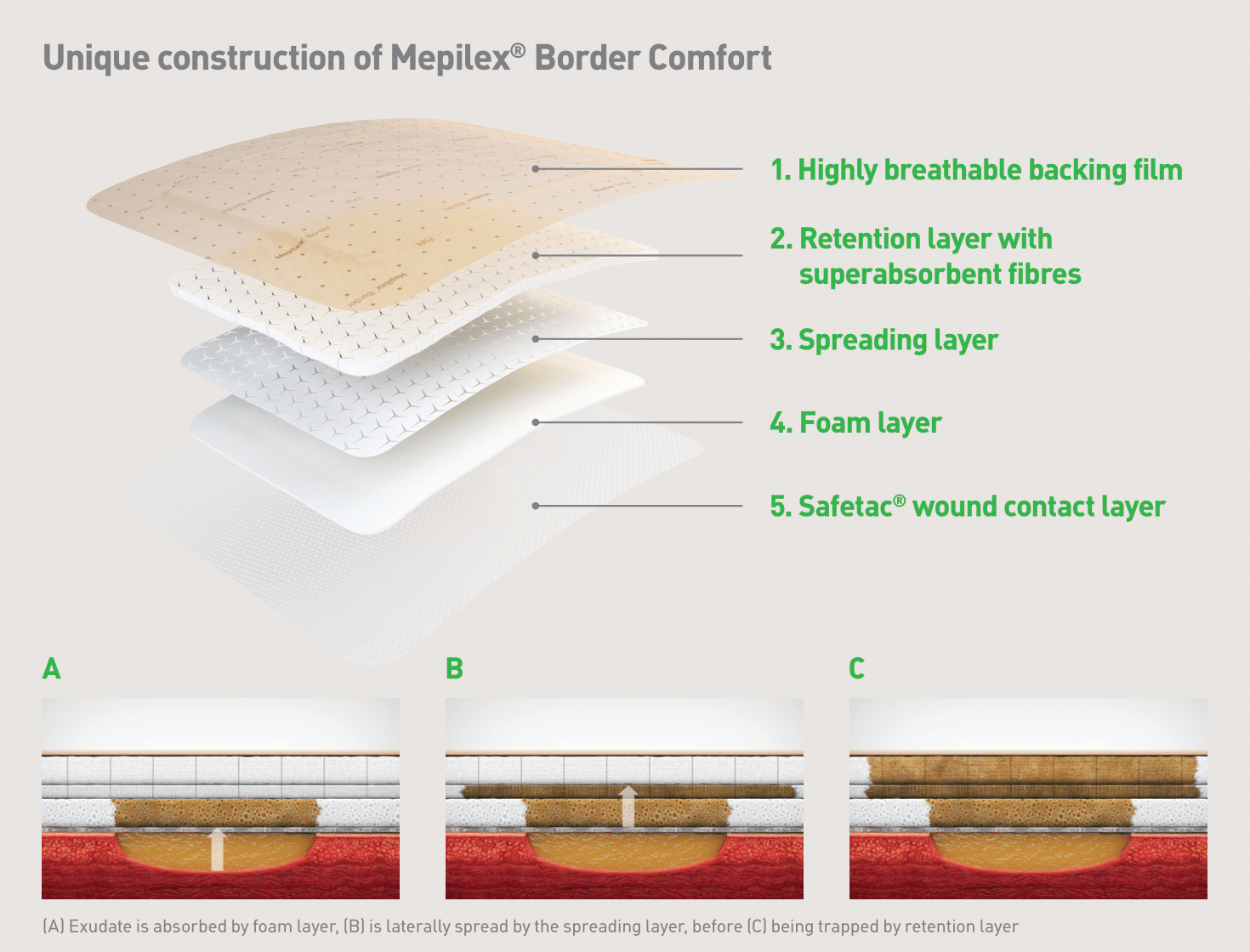Mepilex Border Comfort Lite Foam Dressing