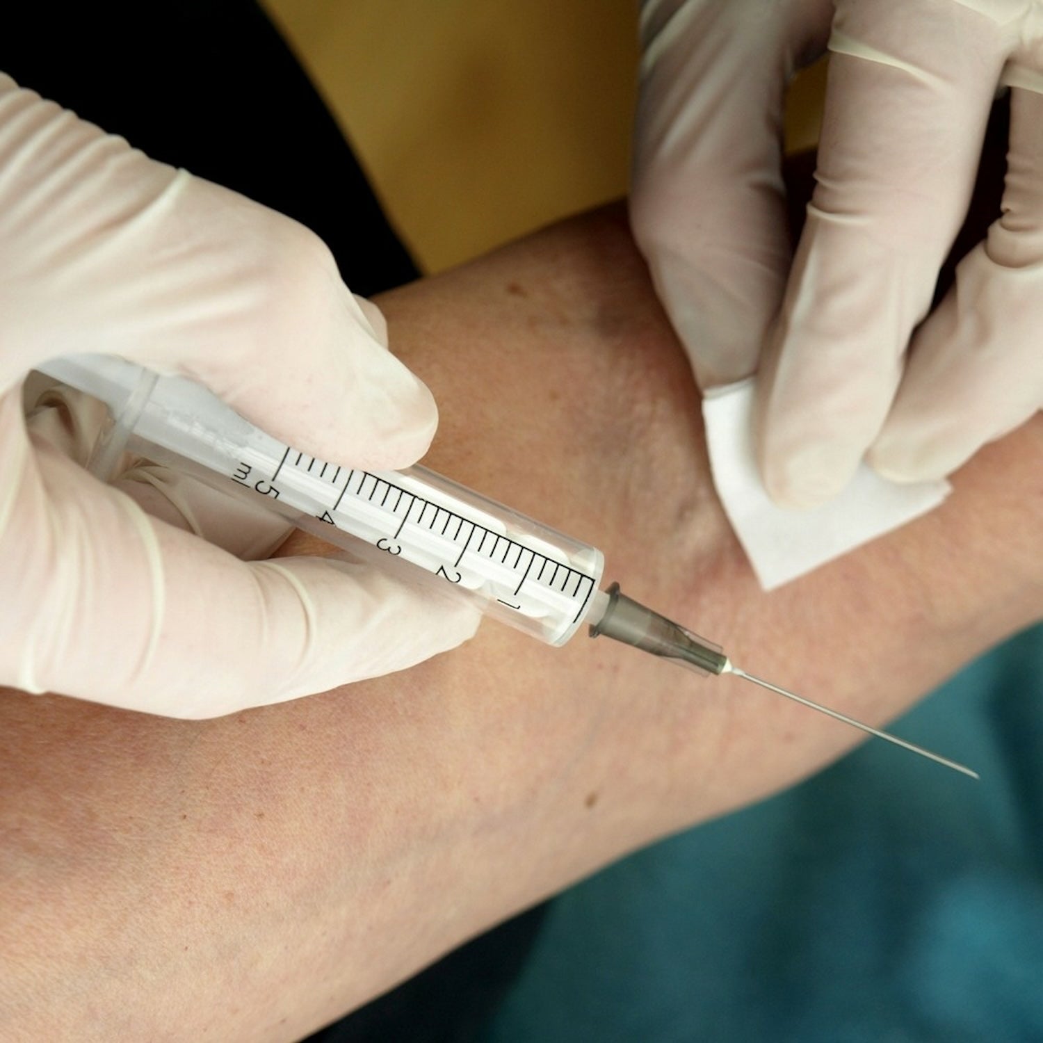 Universal Alcotip PreInjection Swabs | Non Sterile